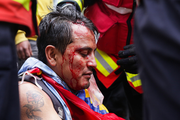 A protester injured in the head by the impact of a tear gas bomb seen during the demonstration. On the twelfth day of protests in Ecuador, at the Arbolito park, indigenous people and the police force clashed during a protest against the government of Guillermo Lasso.