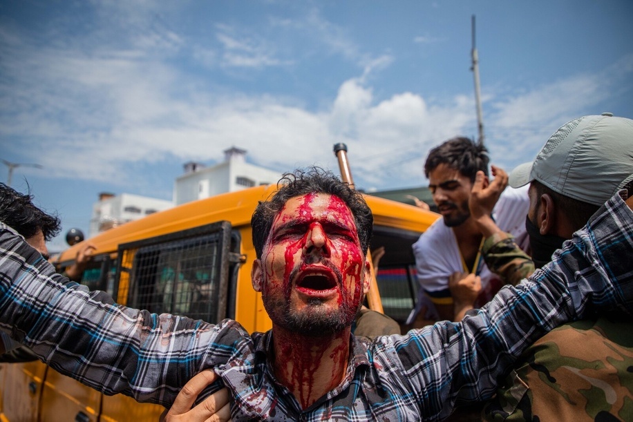 (EDITOR'S NOTE : Image contains graphic content.)
A Kashmiri Shiite Muslim mourner bleeds after he flagellated himself as Indian police detain him, for trying to take part in a Muharram procession in Srinagar. Dozens of Shiite Muslim mourners were detained by Indian police as they tried to take part in the procession during Muharram, the first month of Islamic lunar calendar. India has banned any processions and similar public gatherings in Kashmir after a rebellion against Indian rule broke out in 1989.