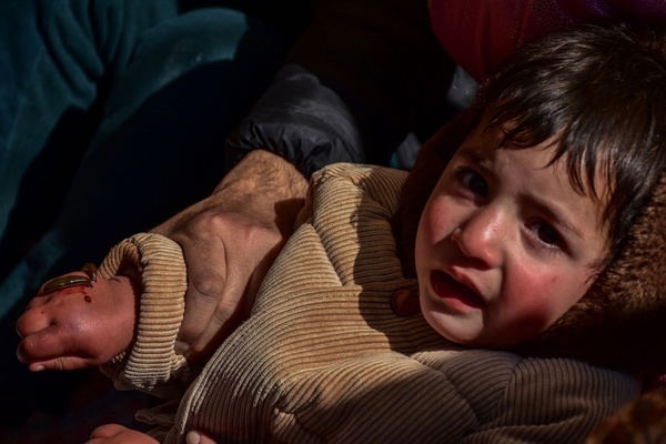 A young patient receives leech therapy on his hand on Nowruz, the day which marks the first day of spring and the beginning of the year in the Persian calendar. Every year traditional health workers in Kashmir Valley use leeches to treat people for small, itchy, painful lumps that develop on the skin called chilblains acquired during winter.