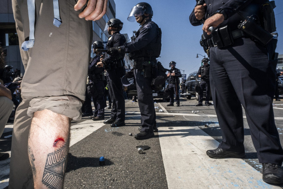 Wound on a protestor from being shot by a rubber bullet weapon by police at the ICE Out of LA Protest. June 8 2025