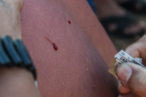 A devotee seen receiving a cut at the back using blade as part of self-flagellation on April 3, 2026, as an act of symbolic participation in the suffering of Jesus Christ. The Catholic Church maintains that physical sacrifice is unnecessary for the forgiveness of sins, many local flagellants continue the grueling practice as a public display of faith, endurance, and communal identity.