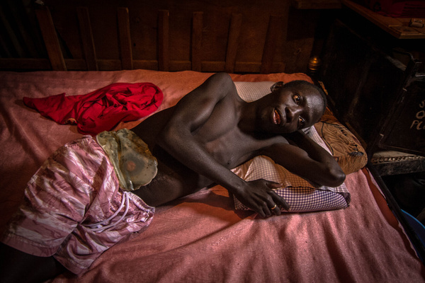 26 year old Evans Ochieng who depends on donations from friends takes a rest on his bed after his colostomy surgery during the pandemic.
Persons with critical health and physical status wary about surviving through the hard times of the Covid-19 Pandemic. According to warnings, people with weak immune systems are at high risk of catching the Virus.