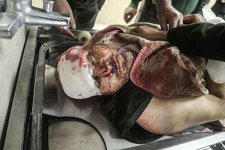 (EDITORS NOTE: Image depicts death)
A body of a Palestinian man killed during an attack by Jewish settlers on Palestinian homes in the village of Qaryut, south of Nablus in the West Bank. The settlers attacked homes, torched Palestinian vehicles, and opened fire on a Palestinian family, killing two brothers and wounding others.