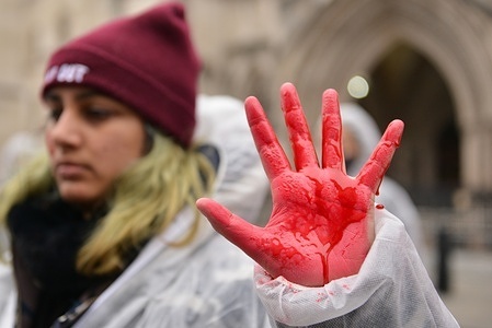 An activist wearing a hazmat suit holds out a hand covered in fake blood during the protest.
Animal rights activists gathered outside the Royal Courts of Justice in London in protest against factory farming.
