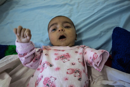 (EDITORS NOTE: Image contains graphic content.)
"Daniel" was found without arm in the ruins of Mosul. Nobody knows where he comes from or where his parents are.
"Daniel" lost one arm after being bitten by a dog. IS used him as a trap. They put him in the middle of street. Three Iraqi soldiers were killed by a sniper while they were trying to save "Daniel".
"Daniel" is a name given to him by Aspen hospital doctors.
The city of Mosul in northern Iraq has been under ISIS control for 3 years until July 2017 when the Iraqi army finally able to liberated the city. The City has been badly destroyed creating a humanities crisis.