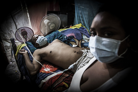 The citizens of Chichigalpa are slowly dying as the conditions have been linked to the fields of sugar cane, which produce molasses for rum to an epidemic kidney disease.
An epidemic of chronic kidney disease of unknown cause (CKDu) is now living in the Chichigalpa community of the Nicaraguan Pacific Coast. This disease mainly affects the younger men who work in the cane plantations. Some scientists suggest that the disease is related to the use of pesticides and fungicides with toxic substances (such as glyphosate) and the extreme working conditions such as high temperatures, excessive physical effort, dehydration, hours under the sun, without right to somba spaces. This is a reality throughout the Central American coast with Nicaragua is the most affected country. According to the Pan American Health Organization, 3,442 men died between 2005 and 2009.