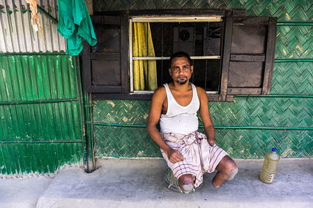 Mahmud Hossain worked in Siddik Ship Breaking Yard, on June 12th 2008 a accident changed his life. He was sitting a narrow space and cutting ship plate with cutting machine, suddenly it slip from his hand and fall over his leg and separated from his body within a second. To protect his leg he used his left hand and he lost it. When Mahmud worked up he found himself in hospital. Ship owner paid his hospital bill but Mahmud didn’t receive any kind of compensation for his disability.