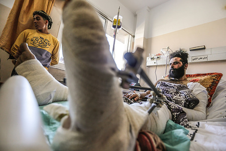 A Palestinian man who was wounded in Israeli airstrikes, lies in Al-Shifa hospital in Gaza City.
In response to days of violent confrontations between Israeli security forces and Palestinians in Jerusalem, various Palestinian militants’ factions in Gaza launched rocket attacks since 10 May that killed at least 12 Israelis to date. 
The Palestinian health ministry said that at least 213 Palestinians, including 61 children, were killed in the retaliatory Israeli airstrikes.