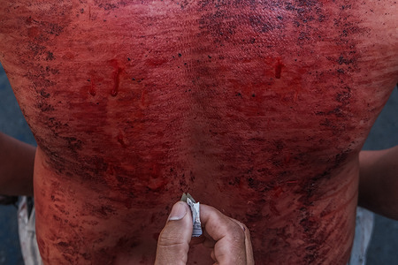 A devotee is seen receiving a cut at the back using blade as part of self-flagellation on April 3, 2026 as an act of symbolic participation in the suffering of Jesus Christ. The Catholic Church maintains that physical sacrifice is unnecessary for the forgiveness of sins, many local flagellants continue the grueling practice as a public display of faith, endurance, and communal identity.