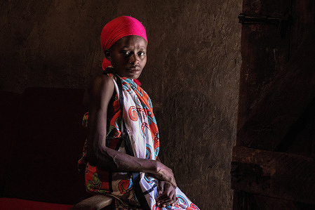 Juliet seated alone at her home in Kibera away from the public.23-year-old Juliet Adhiambo suffers from a Hunchback (Kyphosis), an abnormal curve in the spine that started around the age of 9. She last had surgery back in 2007 and has not been able to afford seeing a specialist or at least medication for her pain. Juliet a single mother living with her three-year-old son and her jobless mother, mostly stays locked inside to avoid mockery from people passing by and even neighbors. Their only income is selling groundnuts by the streets of Kibera at night (where her back is not as visible as in daylight) and Juliet's biggest wish is to be counted as a normal human.