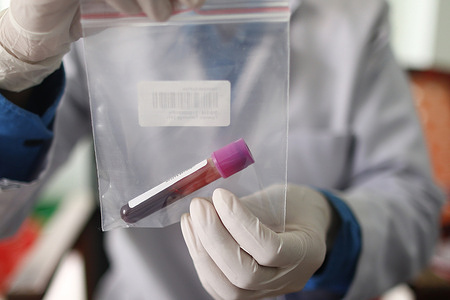 The blood of Liza Bhattarai, 16-years old, is taken for DNA testing to help identify her father, Chan Kumar Bhattarai, 44-years old, who has been missing since flash floods struck the Upper Trishuli-1 hydropower project in Rasuwa, during the blood collection at Nepal Police Hospital.