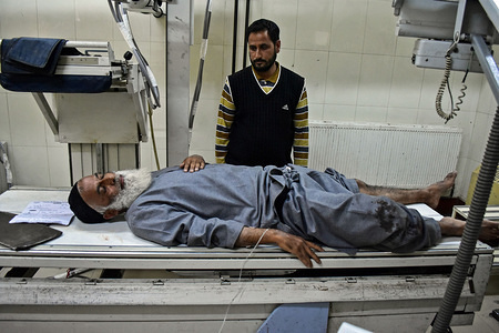 A resident injured in a grenade attack is being treated at a local hospital in Srinagar.
Scores of people were injured in a grenade attack by suspected militants here in Srinagar on Saturday afternoon. The explosion also damaged windows of a vehicles parked nearby. The attack comes despite tight security since the centre scraped the Article 370, which grants special status to Jammu & Kashmir on August 5.