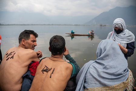 Kashmiri residents receive leech treatment on their back on the bank of Dal Lake. Every year on Nowroz 21st March, traditional health workers in Kashmir use leeches to treat people who have itchy, painful lumps on their skin called chilblains that develop during the winter. Thousands of patients with various skin problems receive leech treatment at Hazratbal in Srinagar.