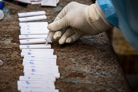 A health worker is sampling the swab test samples for RTPCR testing at Madhyamgram Rural Hospital, Kolkata.
India faces a massive hike in Covid-19 cases, reported more than 90000 cases and 325 deaths in the last 24 hours, recording a sharp spike of over 56% as per Indian media reports. Govt of India has ramped up the vaccination process as well as RT-PCR testing to control the spreading of the virus.